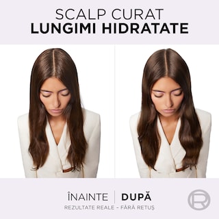 Elseve | Balsam rehidratant Hyaluron Pure 200ml