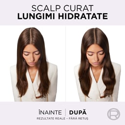 Elseve | Balsam rehidratant Hyaluron Pure 200ml