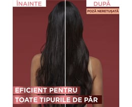 Elseve | Ser Aminexil Full Resist 100ml