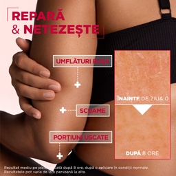 Mixa | Crema regeneratoare multi-use Urea Cica Repair 400ml