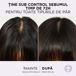 Elseve | Ser purificator Hyaluron Pure 102ml