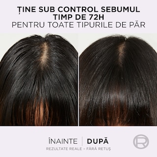 Elseve | Ser purificator Hyaluron Pure 102ml