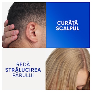 Head&Shoulders | Sampon pentru par Apple Cider 400ml