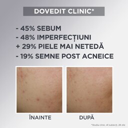 Garnier | Crema matifianta 50ml