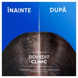 Head&Shoulders | Sampon pentru par Sensitiv 400ml