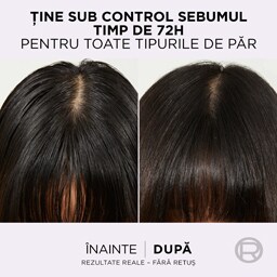 Elseve | Ser purificator Hyaluron Pure 102ml
