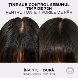 Elseve | Ser purificator Hyaluron Pure 102ml