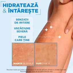 Mixa | Crema cu efect fortifiant pentru fata si corp  400ml