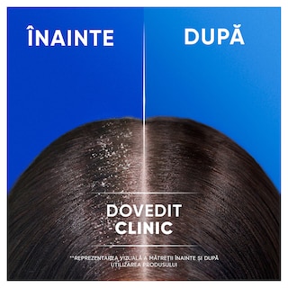 Head&Shoulders | Sampon pentru par Sensitiv 400ml
