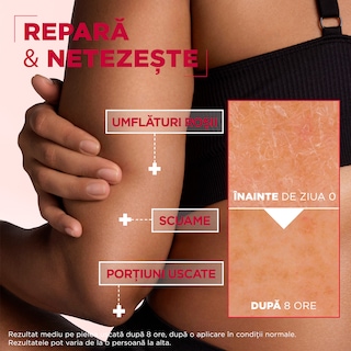 Mixa | Crema regeneratoare multi-use Urea Cica Repair 400ml